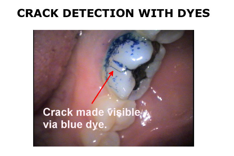 crack-detection-staining