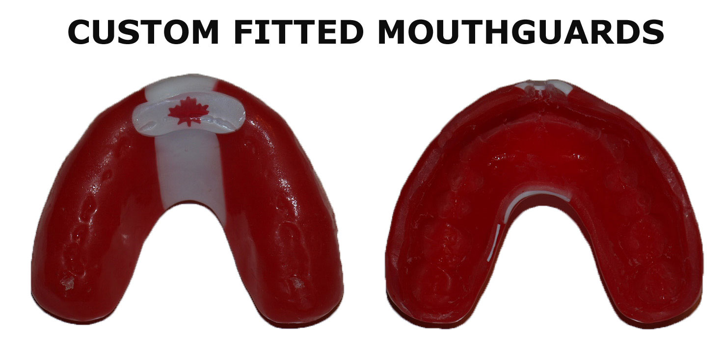 custom-mouthguard